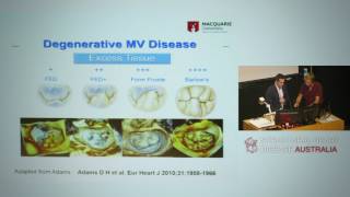 Assessment of the mitral valve through imaging – Dr Jason Kaplan