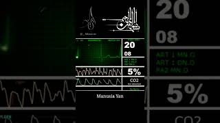 Download lagu SAKARATUL MAUT [ AJAL ] #ajal #kematian #icu #feedshorts #feed mp3