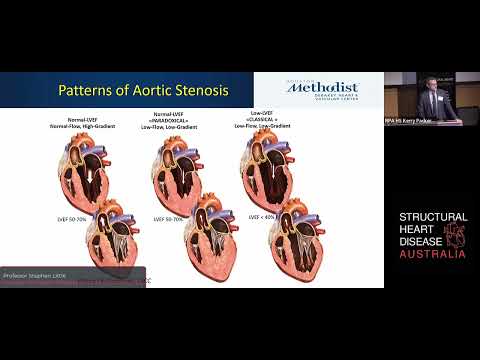 Aortic stenosis Guidelines - TAVI patient selection - Prof Stephen Little