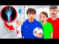 A Little Boy Broke Jalal S Hand Playing Football