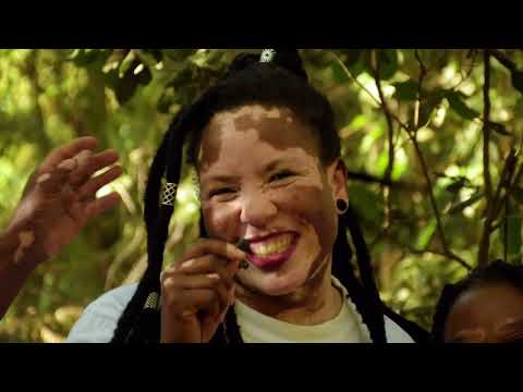 Vitiligo -Our Stories  @royalpatches254 @canaldovitiligo