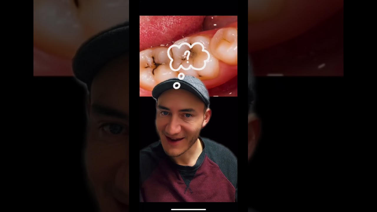 Watch ¿Te lavas muy bien los dientes y aún así tienes caries Podría ser por esto: Now ¿Te lavas muy bien los dientes y aún así tienes caries Podría ser por esto: