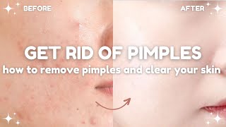 how to get rid of pimples and clear your skin 🧴🫧 acne treatments and do