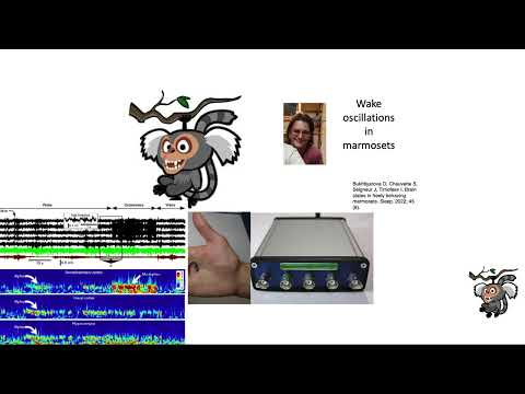 Igor Timofeev (Laval Univ) - Brain States, Neuronal Excitability and Seizures (1/23/25)