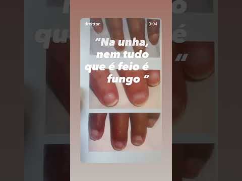 Rubem Antonio Citton Junior-12