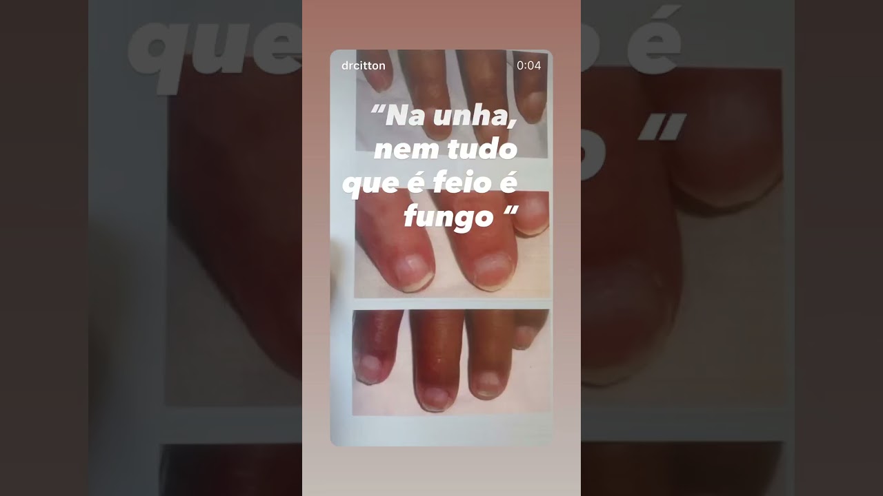 Rubem Antonio Citton Junior-12