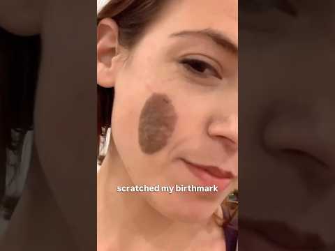 Would you have said anything? #jokes #standupcomedy #weird #cat #birthmark #mole