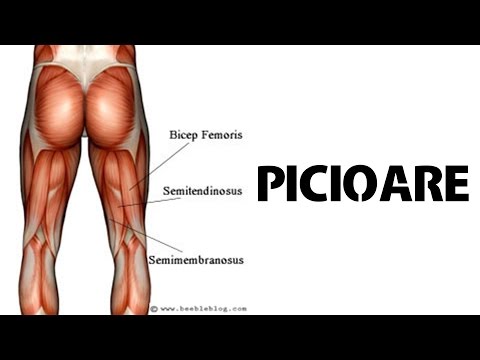 Coxartroza articulației genunchiului și tratamentul acesteia