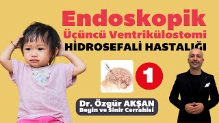 Endoskopik Üçüncü Ventrikülostomi - Dr. Özgür Akşan (Bölüm-1) #hidrosefali