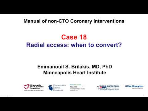 Case 18: PCI Manual: Radial PCI - when to switch?