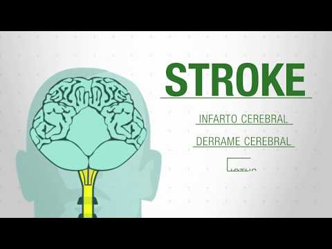 download lagu mp3 mp4 Que Significa Stroke En Espaol, download lagu Que Significa Stroke En Espaol gratis, unduh video klip Que Significa Stroke En Espaol