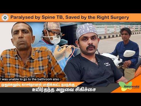Paralyzed by Spine TB, Saved by the Right Surgery - patient testimonial