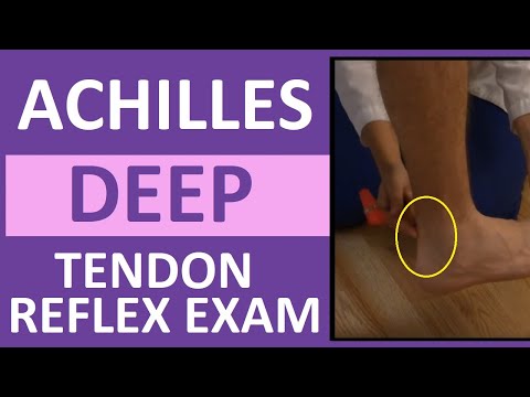 Autonomic Dysreflexia Hyperreflexia Nursing Review Symptoms Treatment