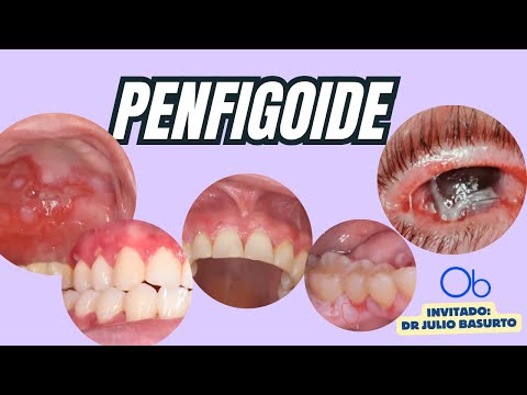 Penfigoide