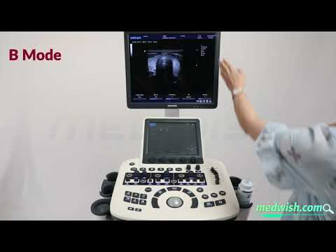 3D 4D Color Doppler Ultrasound Machine