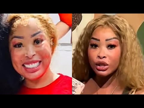 Khanyi Mbau REGRETS Getting A Facelift⁉️