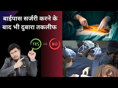 The Dangers Graft Stenosis in  Post-Bypass Surgery patients