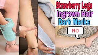 Remove 🍓STRAWBERRY LEGS in 1 Week |Waxing/Shaving Tips | Super Style Tips