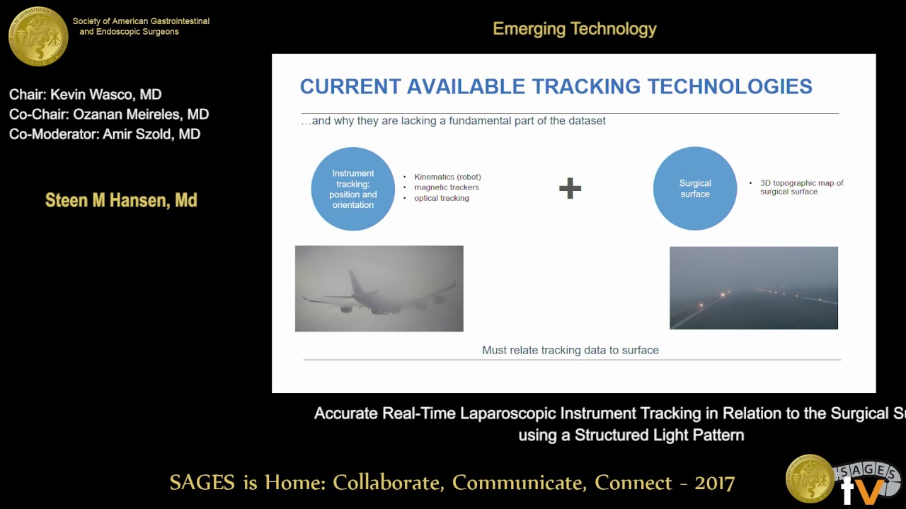 Accurate real time laparoscopic instrument tracking in relation to the surgical surface using a stru