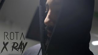 X-Ray Music Video