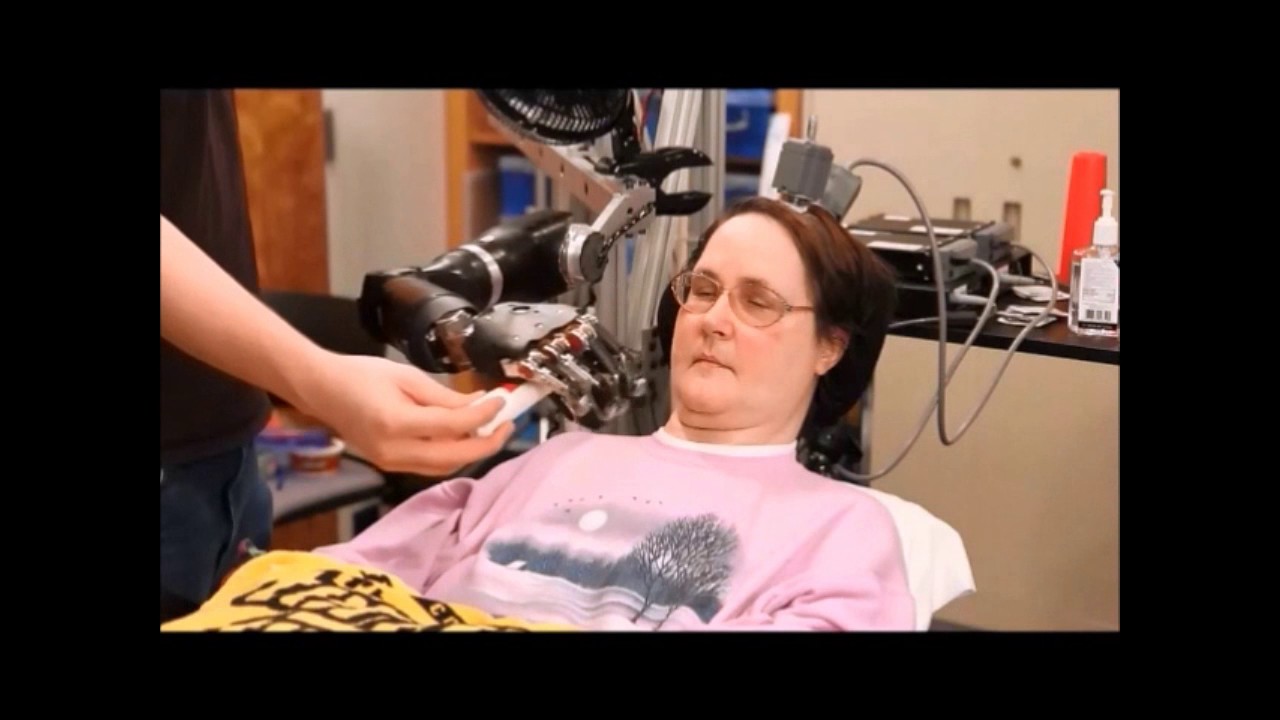 Brain Computer Interfaces and Regenerative Rehabilitation