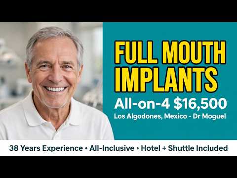 Real Patient Story - Full Mouth Implants Los Algodones, Mexico | Dr Moguel