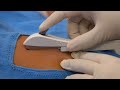 Inserting a One Rod Implant, Teaching Short (Health Workers) - Family Planning Series