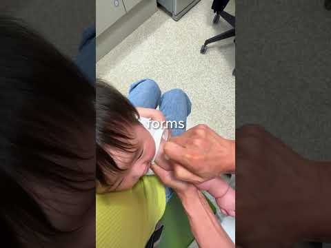 Why so many needles?🤔