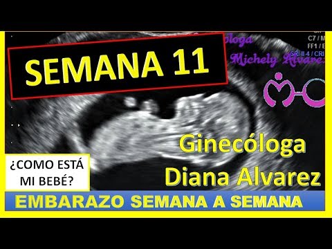 PREGNANCY WEEK BY WEEK, WEEK 11, BY GYNECOLOGIST DIANA ALVAREZ