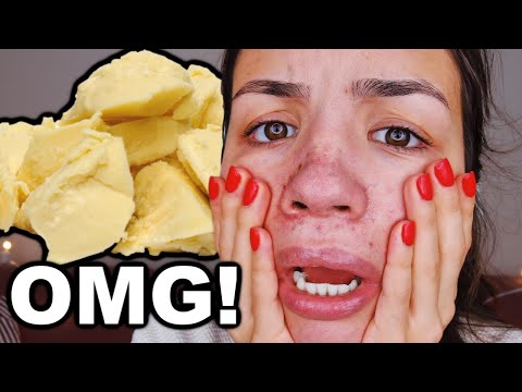 OMG! I Used Shea Butter On My Skin Everyday For One...