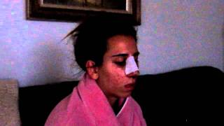 My Rhinoplasty Recovery: #3