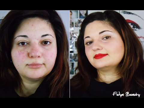 La pigmentazione su una faccia al bambino che fare Come combattere nellestate contro pigmentary nota su una faccia