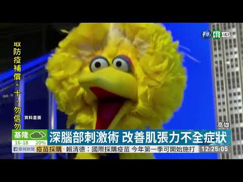 電極刺激腦部 肌張力不全症者福音