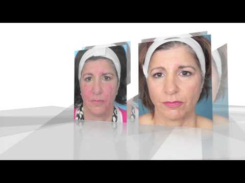 RM DMMD Testimonial Nu-Living