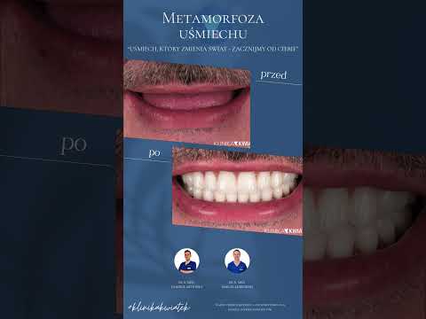 Marcin Lenkowski-12