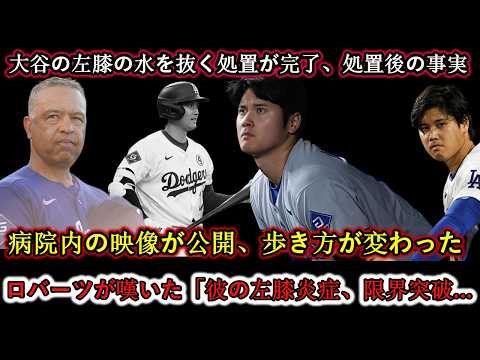 【衝撃事実】大谷翔平、[左膝](https://sugutopi.com/%e5%a4%a7%e8%b0%b7%e7%bf%94%e5%b9%b3%e3%81%ae%e5%b7%a6%e8%86%9d%e3%81%afmri%e3%81%a7%e7%95%b0%e5%b8%b8%e3%81%aa%e3%81%97%e3%80%81%e7%9b%97%e5%a1%81%e6%99%82%e3%81%ae%e9%81%95%e5%92%8c%e6%84%9f/)の水抜き後に見せた異変…病院内映像で広がる心配。ロバーツ監督が嘆いた悲痛な本音「彼はもう限界に達している」