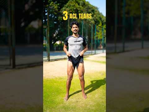 3 ACL Tears | ACL Injury #aclinjury #acltear #aclrecovery