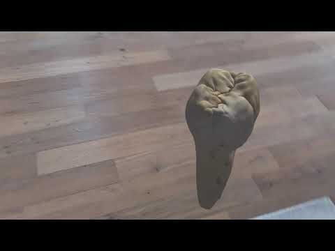 Dental Hololens 2 Demo
