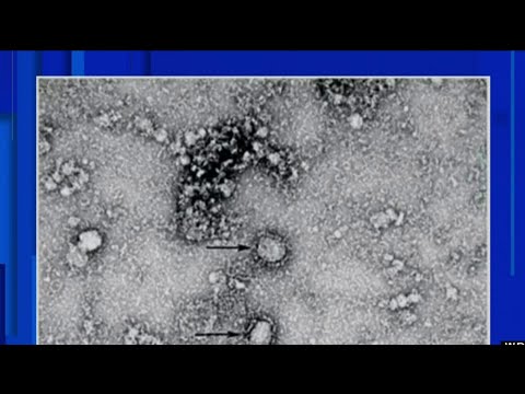 MDHHS、住民にミシガン州のコロナウイルスの可能性を心配するなと指示 (MDHHS tells residents to not worry over potential Michigan coronavirus cases)