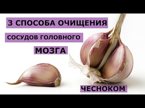 Если болит в левом паху и пояснице Наложения повязки на коленный сустав расходящаяся