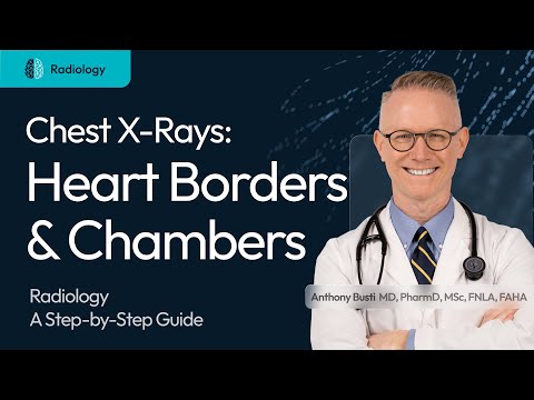 Heart Borders & Chambers on a Chest X-Ray - Made Easy