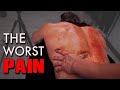 THE WORST PAIN❗️Fixing CHRONIC & COMMON BACK PAIN | Trigger Point Treatment (Inc. Home Exercises)