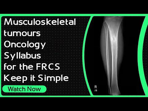 Musculoskeletal Tumours