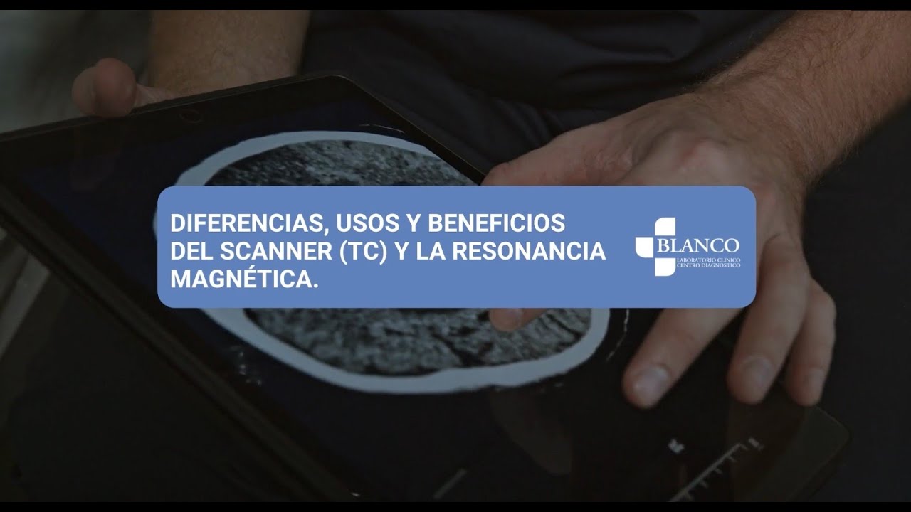 Aprende junto a Laboratorio Blanco: diferencias Scanner (TC) y Resonancia Magnética.