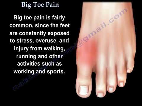 Understanding and Treating Big Toe Pain: Causes, Conditions, and Solutions