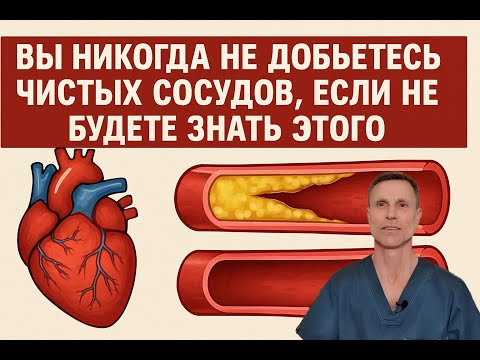 Без этого знания невозможно добиться здоровых сосудов без бляшек Без этого знания невозможно добиться здоровых сосудов без бляшек