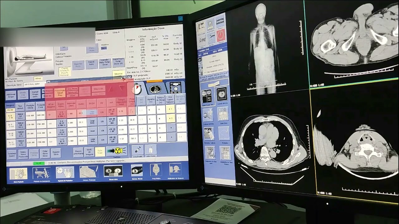Tomografia -  Crânio + Tórax + Abdome trifásico