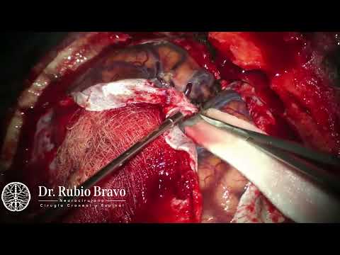 Jose  Rubio Bravo-5