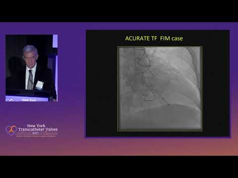 New Next Generation TAVR Technology 2020