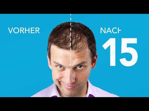 COVER HAIR - Dichtes Haar in 15 Sekunden